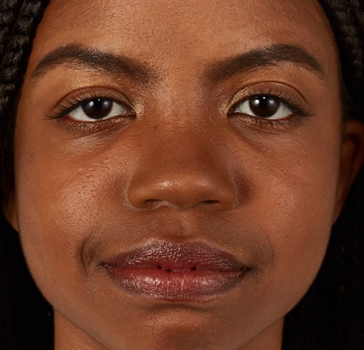 complexion after